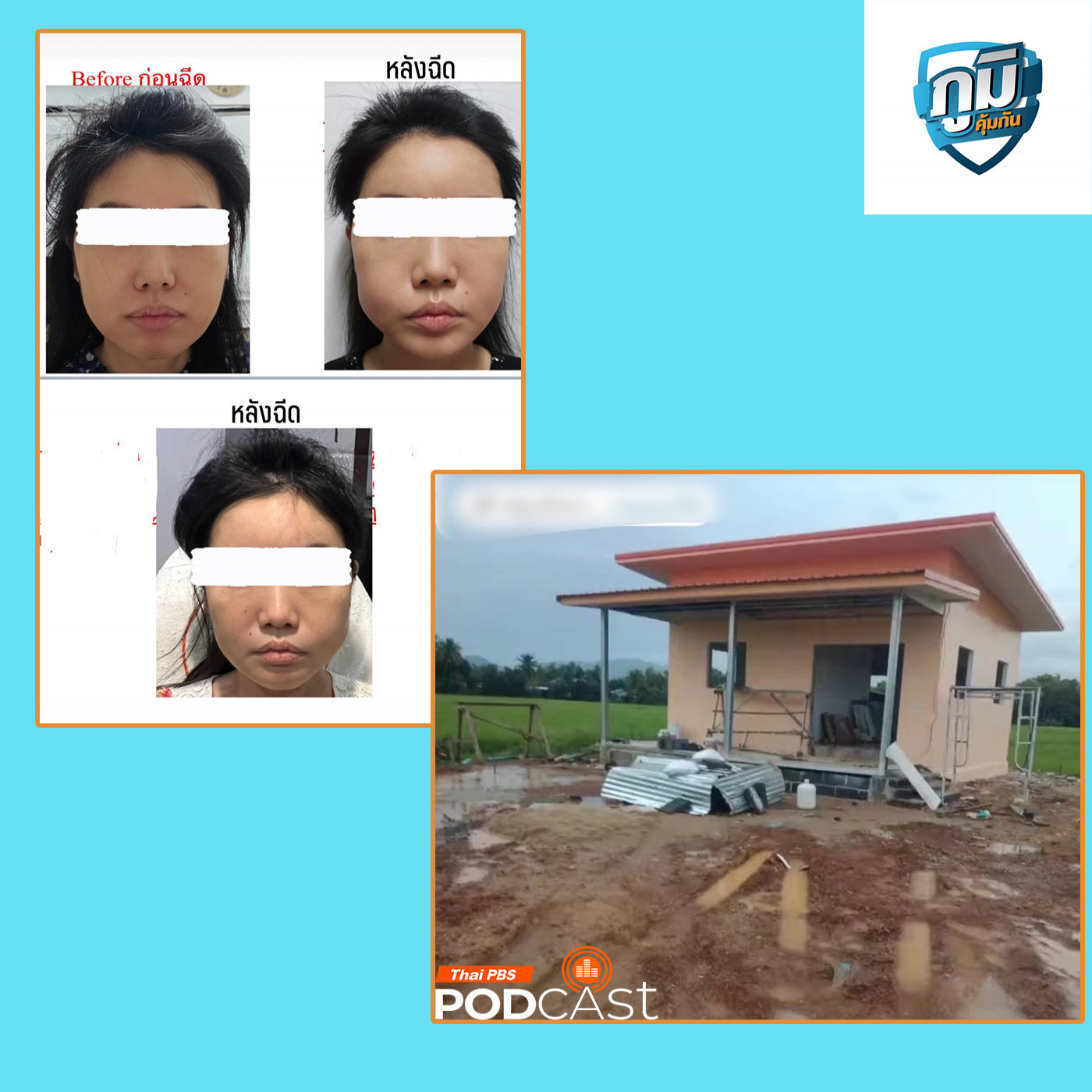 ภูมิคุ้มกัน : ร้อง! ผู้รับเหมาทิ้งงานสร้างบ้าน / ร้อง! ถูกเจ้าของคลินิกชื่อดังฉีดหน้าเกินกว่าปริมาณทำให้หน้าเบี้ยว / อาหารที่เหม็นหืนอันตรายหรือไม่