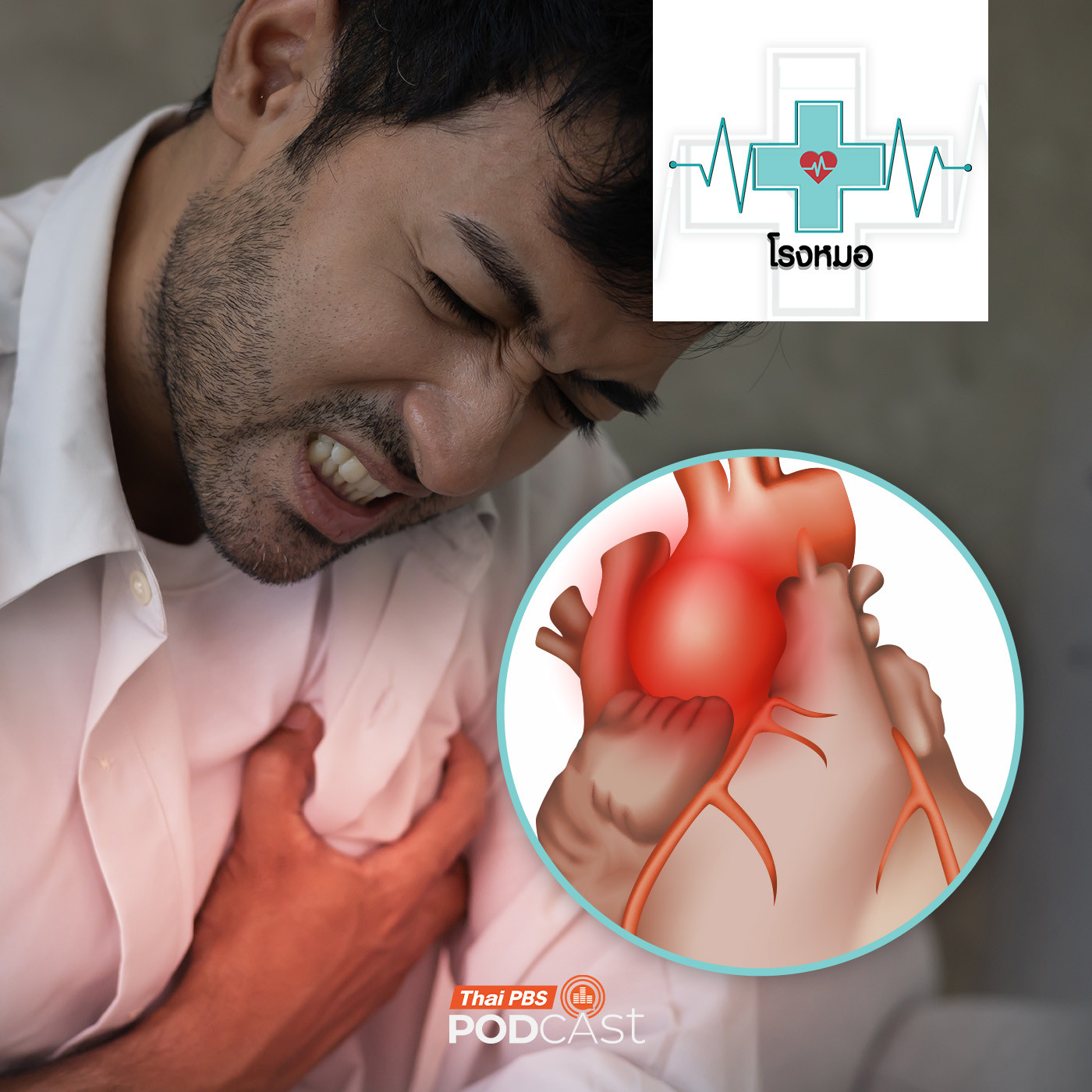 โรงหมอ EP. 1137: หลอดเลือดแดงโป่งพอง ภัยเงียบเสี่ยงชีวิต
