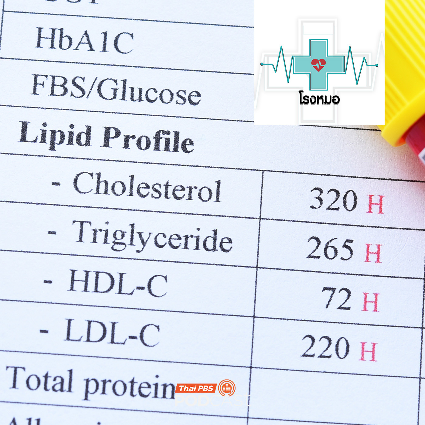 โรงหมอ EP. 1146: ตัวเลขไขมันในเลือด บอกระดับสุขภาพแบบปฏิเสธไม่ได้