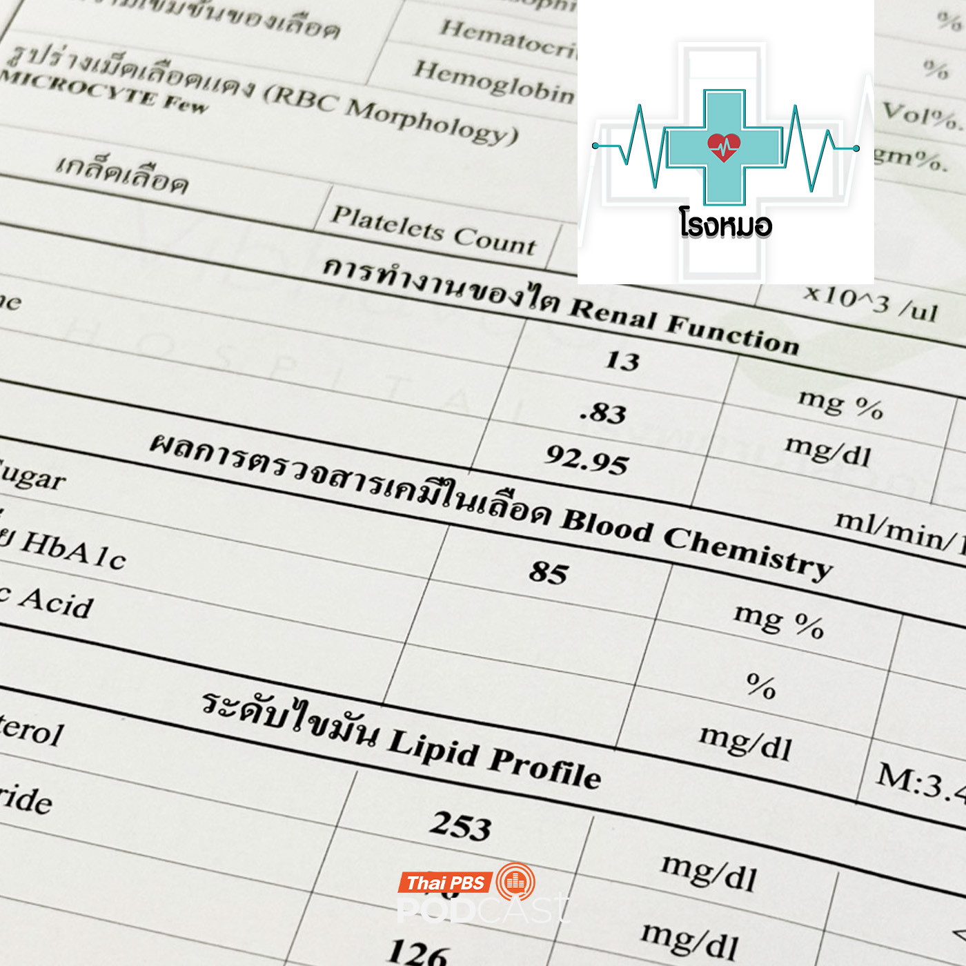 โรงหมอ EP. 1162: ตัวเลขกับความหมายที่ซ่อนเร้นจากผลตรวจสุขภาพ โรงหมอ EP. 1162: ตัวเลขกับความหมายที่ซ่อนเร้นจากผลตรวจสุขภาพ