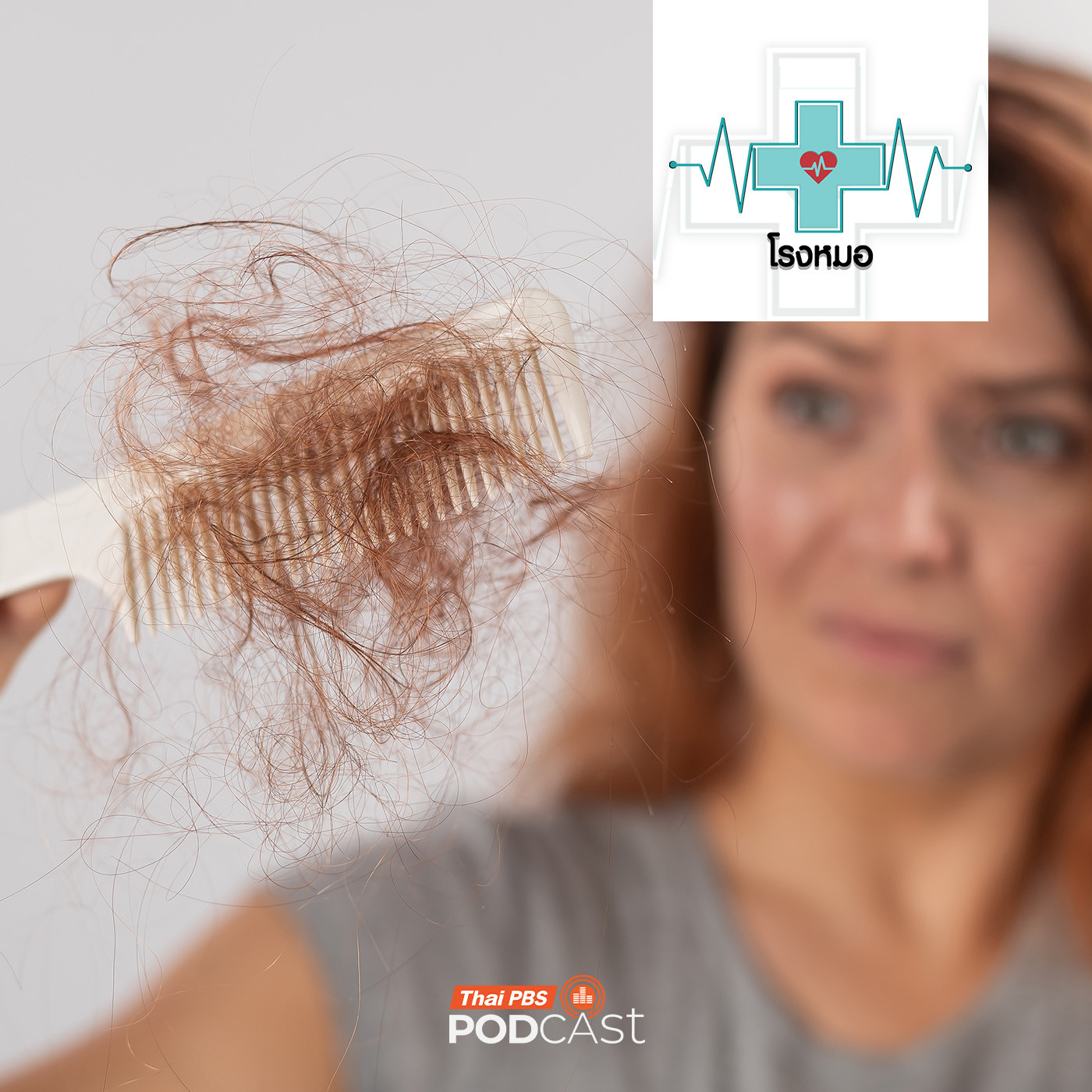 โรงหมอ EP. 1175: ผมร่วงเพราะถูกทำลายจากความเครียดและวิตกกังวล