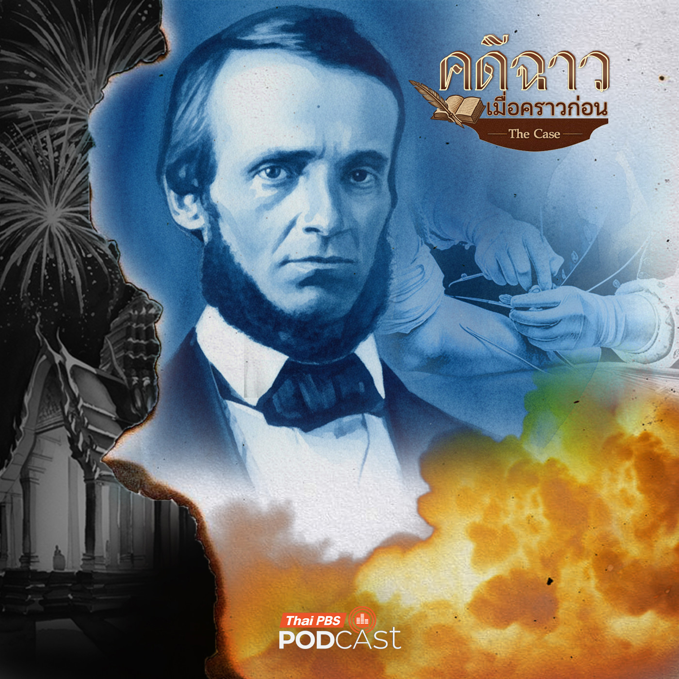 EP. 4: พลุปืนใหญ่ระเบิดกับการผ่าตัดครั้งแรกในสยาม