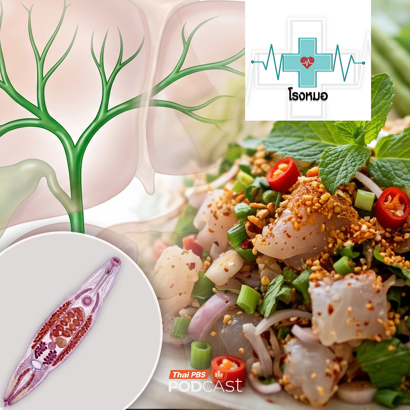 EP. 1252: พยาธิใบไม้ในตับ ตัวร้ายเมนูสดดิบรสแซ่บนัว เสี่ยงเป็นมะเร็งท่อน้ำดี